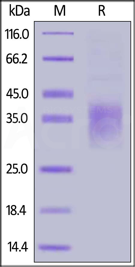 Human NKG2A, His Tag (Cat. No. NKA-H5244) SDS-PAGE gel