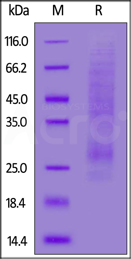 Cynomolgus NKG2C, His Tag (Cat. No. NKC-C5247) SDS-PAGE gel