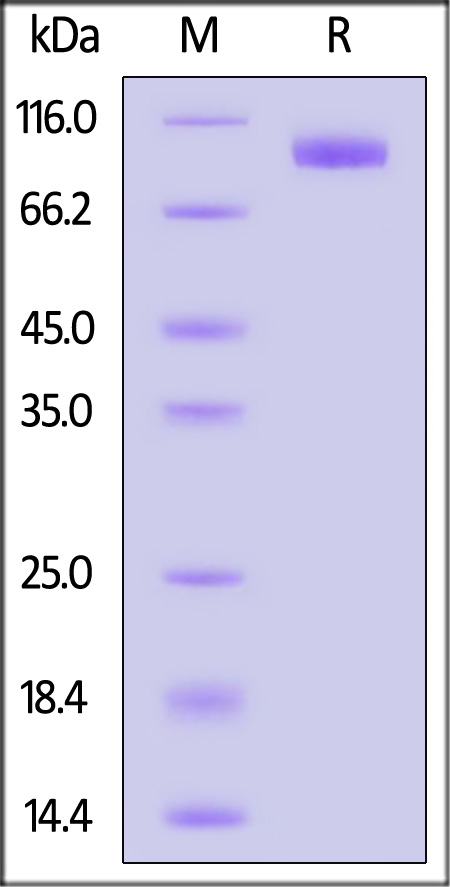 NPR1 SDS-PAGE