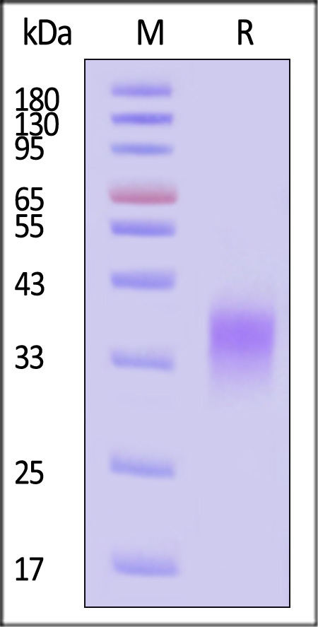 ProS1 SDS-PAGE