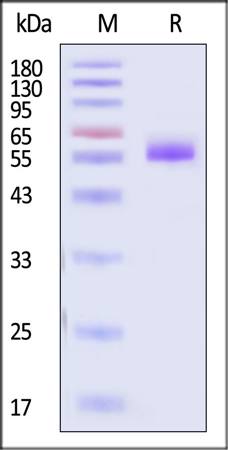 Prolactin SDS-PAGE