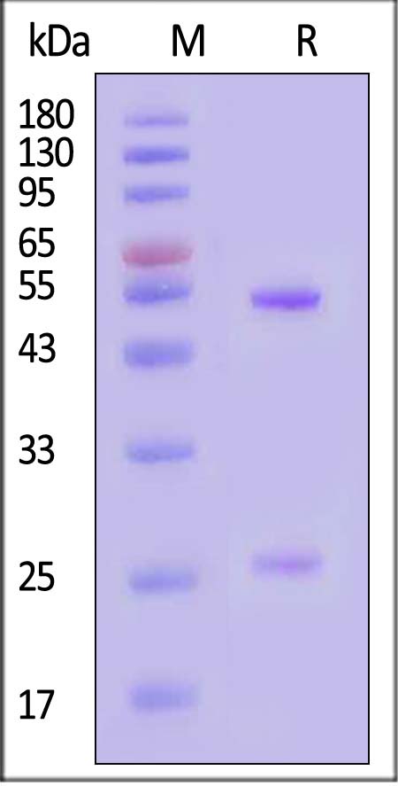 Glycoprotein C/Gc protein (SFTSV) SDS-PAGE