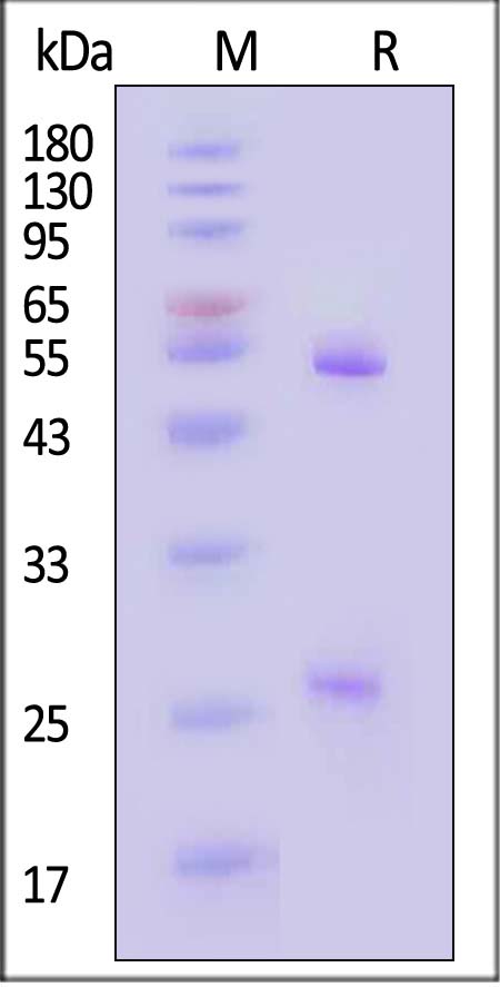 Glycoprotein C/Gc protein (SFTSV) SDS-PAGE