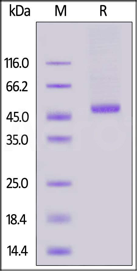 Human RENIN, His Tag (Cat. No. REN-H5221) SDS-PAGE gel