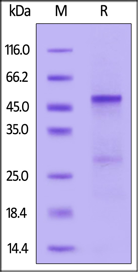 Human Serpin H1, His Tag (Cat. No. SE1-H5224) SDS-PAGE gel