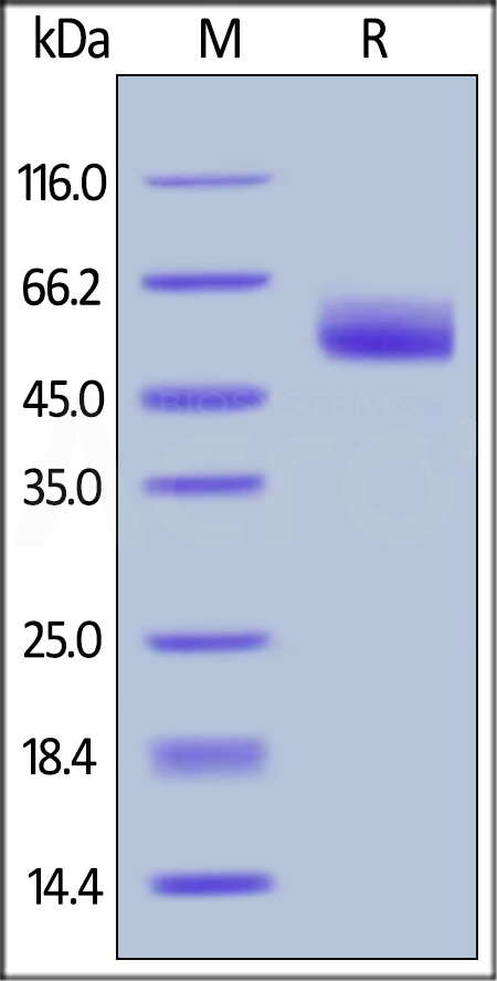 Serpin A3 SDS-PAGE