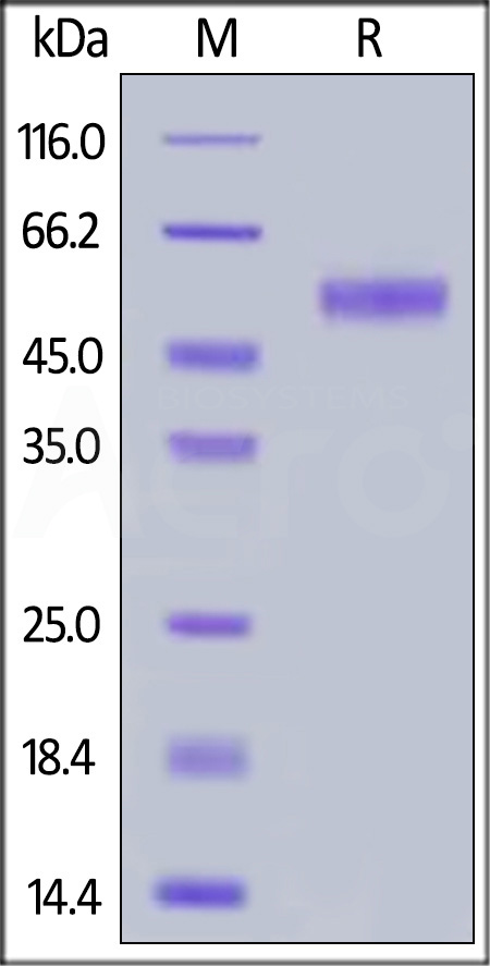 Human Siglec-8, His Tag (Cat. No. SI8-H52H8) SDS-PAGE gel