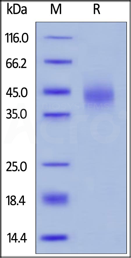 Human TFPI, His Tag (Cat. No. TFI-H5226) SDS-PAGE gel