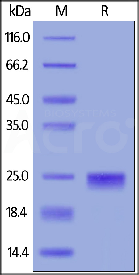 TIMP-2 SDS-PAGE