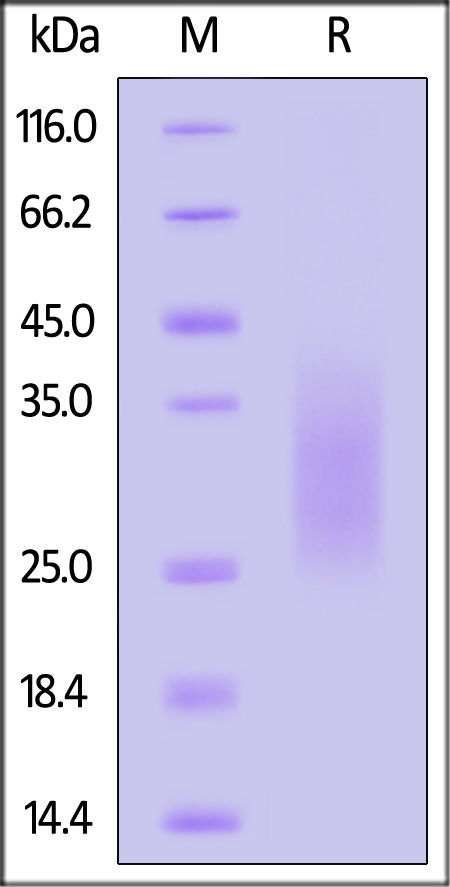 TRAC SDS-PAGE