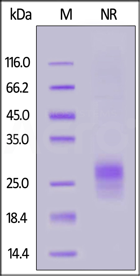 TSLP SDS-PAGE