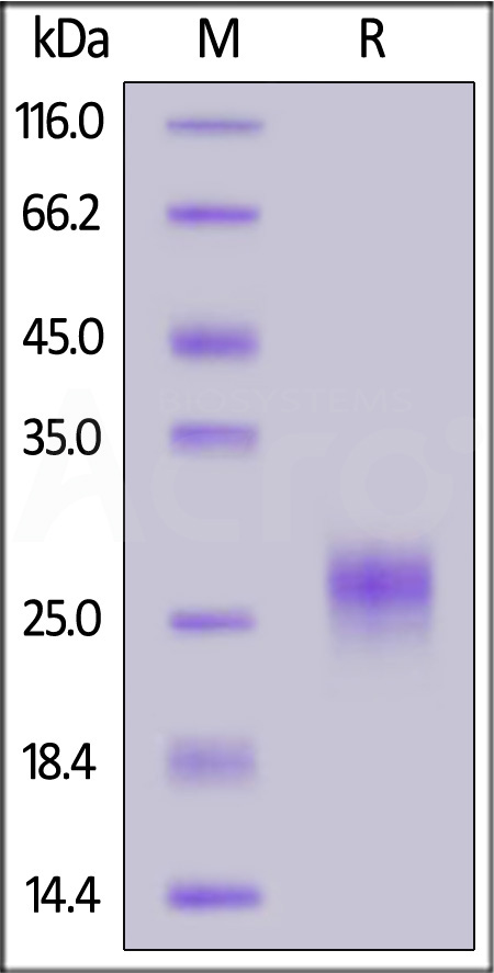 TSLP SDS-PAGE