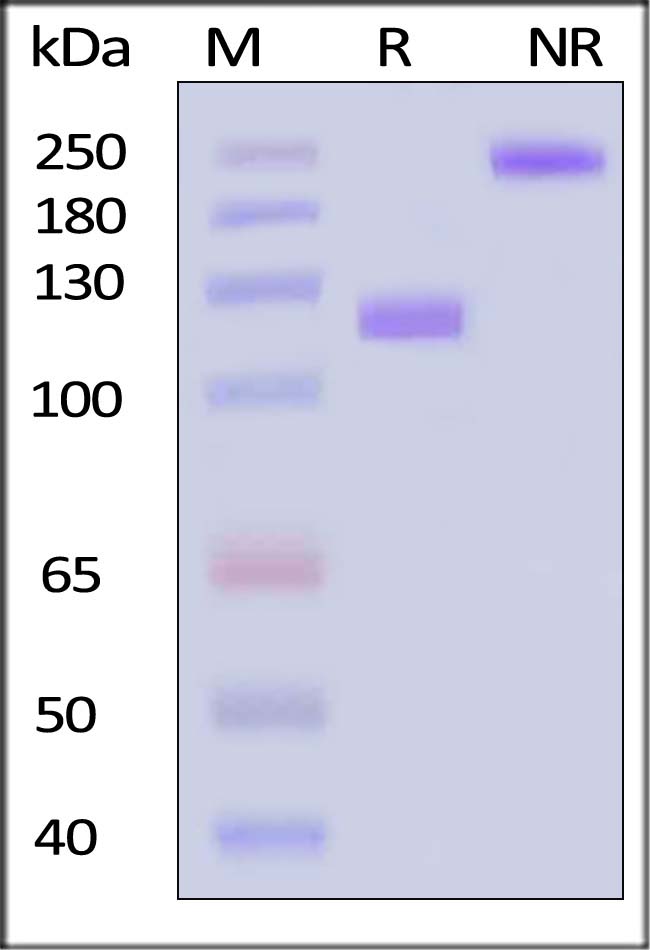 VCAM-1 SDS-PAGE