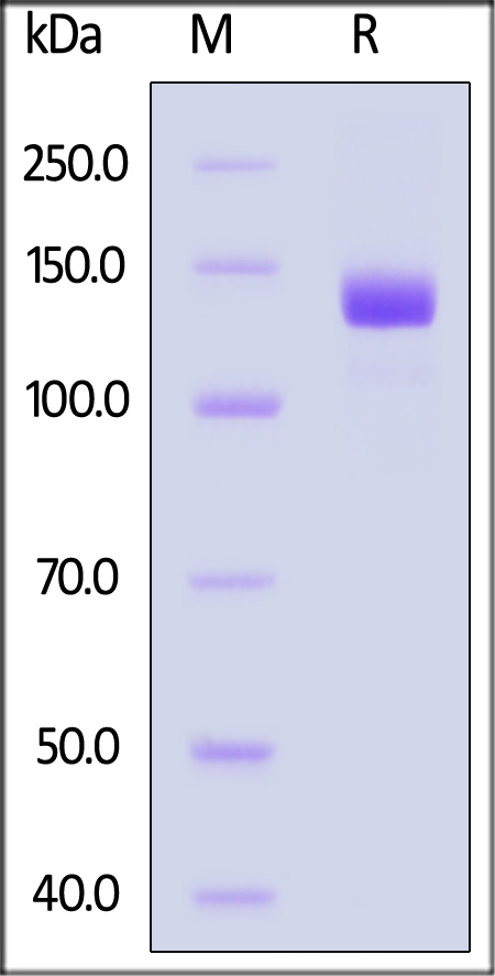 Vinculin SDS-PAGE