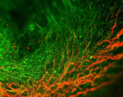 AD / PD Disease Modeling