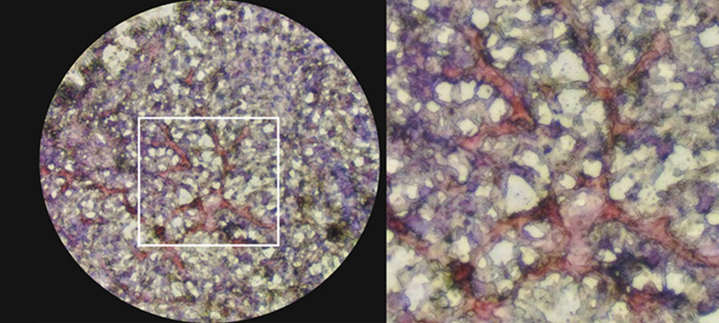 Hepatotoxicity Tests on a NASH Model