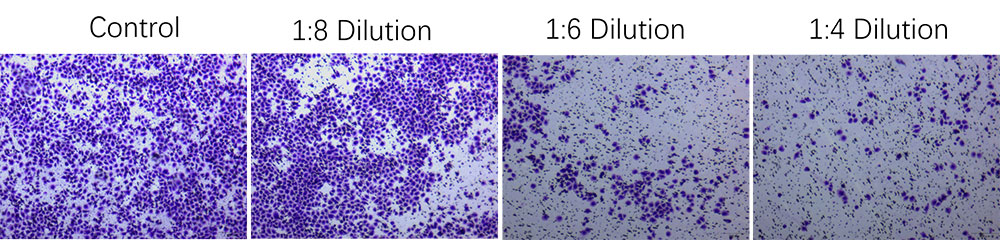 Tumor Cell Invasion