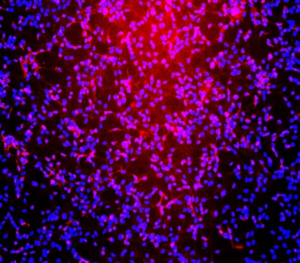  NG2/Cspg4 IMMUNOSTAINING