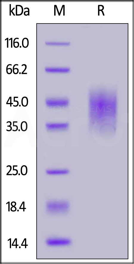 Human B7-H5, His Tag (Cat. No. B75-H52H0) SDS-PAGE gel