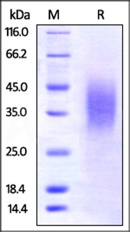 BTLA SDS-PAGE