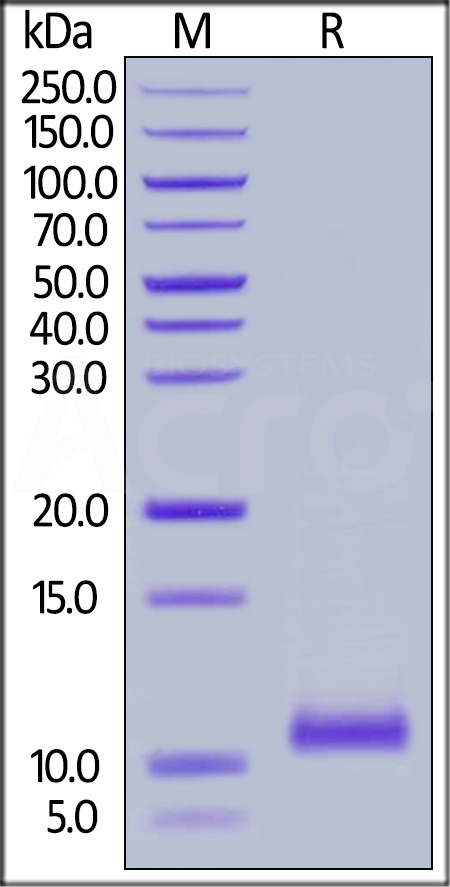 Complement C5a SDS-PAGE