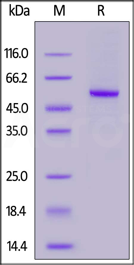 Carbonic Anhydrase IX SDS-PAGE