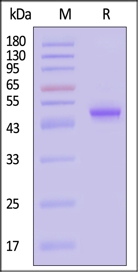 Carbonic Anhydrase IX SDS-PAGE