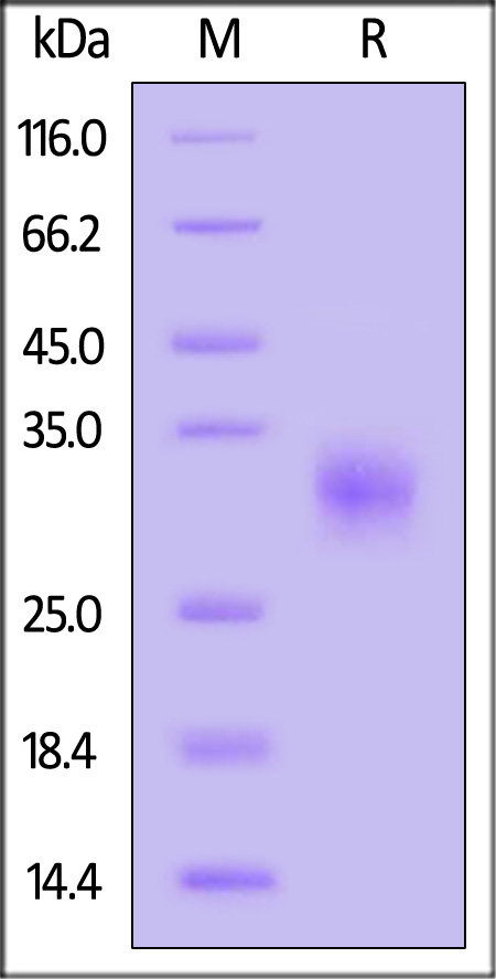 Fc gamma RIIB/C / CD32b/c SDS-PAGE