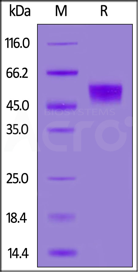 Human CD16b (NA1), SUMO,His Tag (Cat. No. CDB-H5296) SDS-PAGE gel