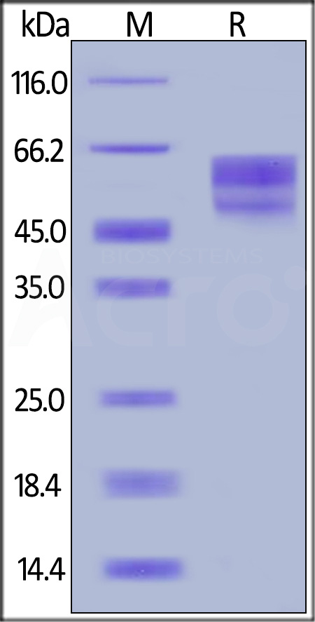 CD3E & CD3D SDS-PAGE