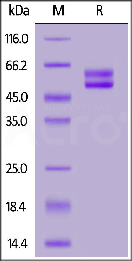 CD3E & CD3D SDS-PAGE