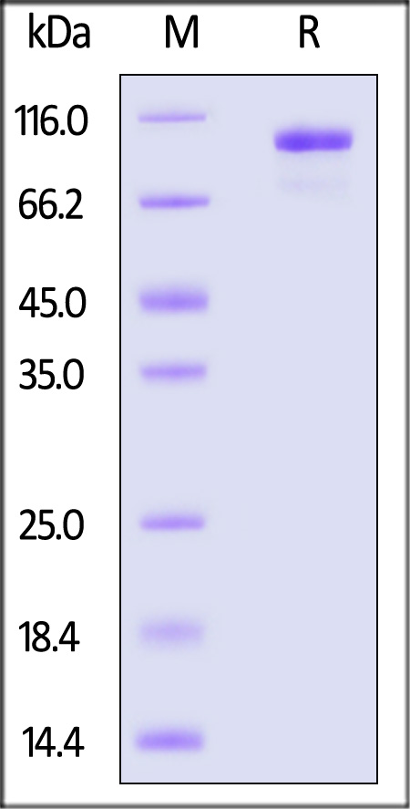 Complement C2 SDS-PAGE