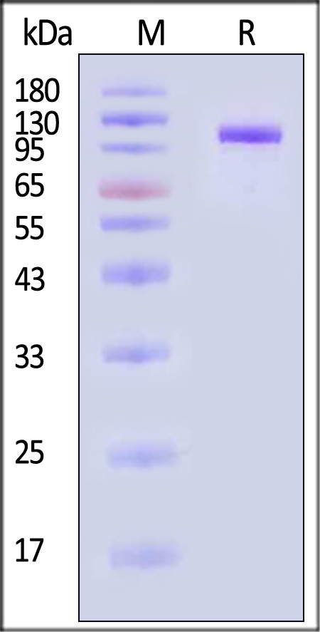 Complement C2 SDS-PAGE