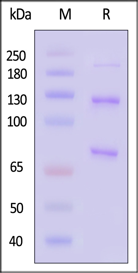 Complement C3 SDS-PAGE