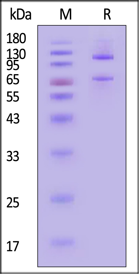 Complement C5 SDS-PAGE