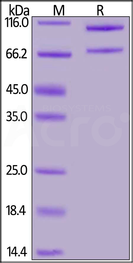 Complement C5 SDS-PAGE