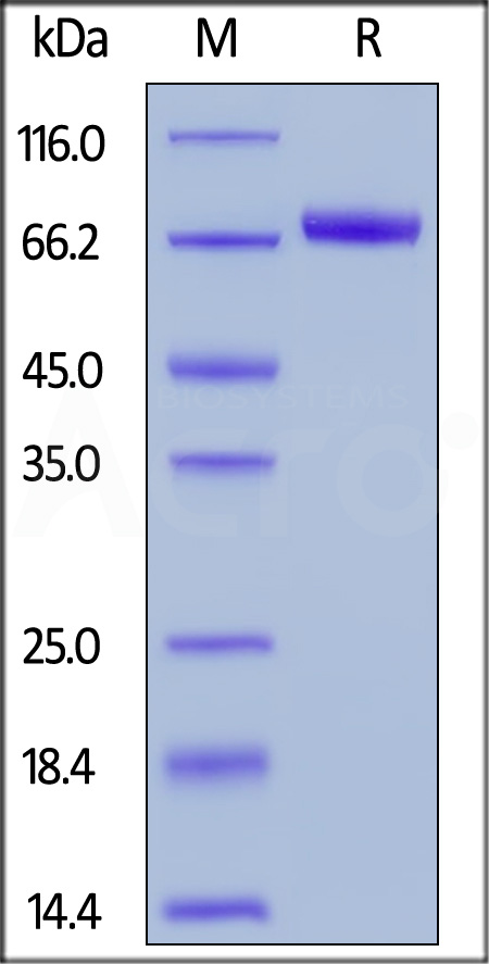 Dkk-1 SDS-PAGE