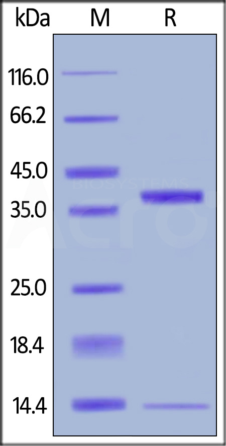 FcRn (FCGRT & B2M) SDS-PAGE