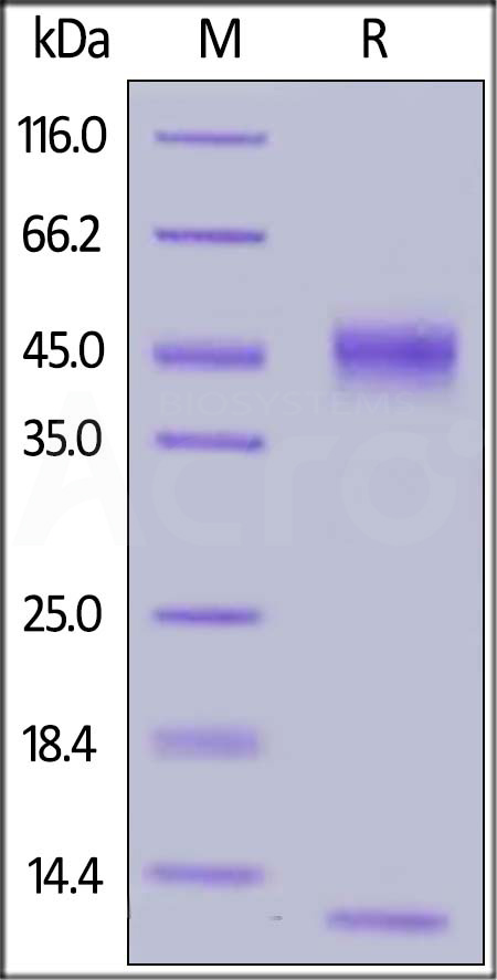 FcRn (FCGRT & B2M) SDS-PAGE