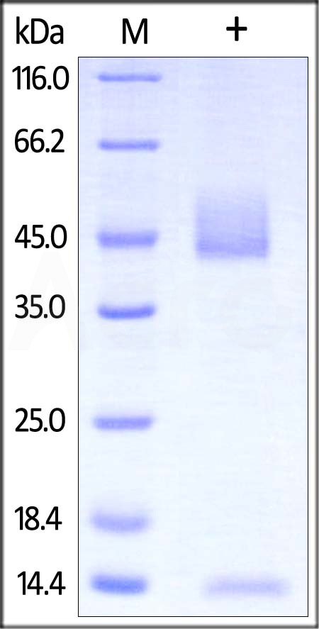 FcRn (FCGRT & B2M) SDS-PAGE