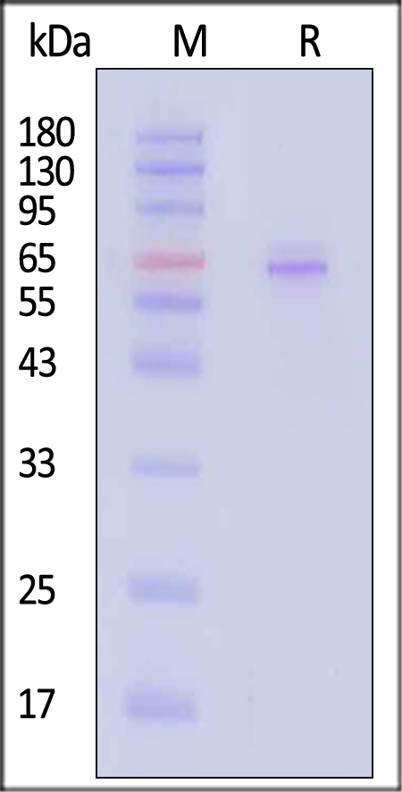 GAD2 SDS-PAGE