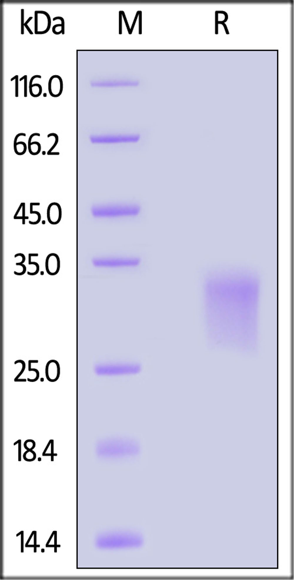 GLP1R SDS-PAGE