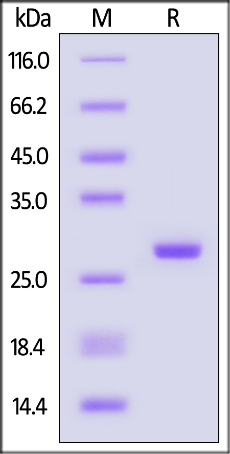 Nuclease SDS-PAGE