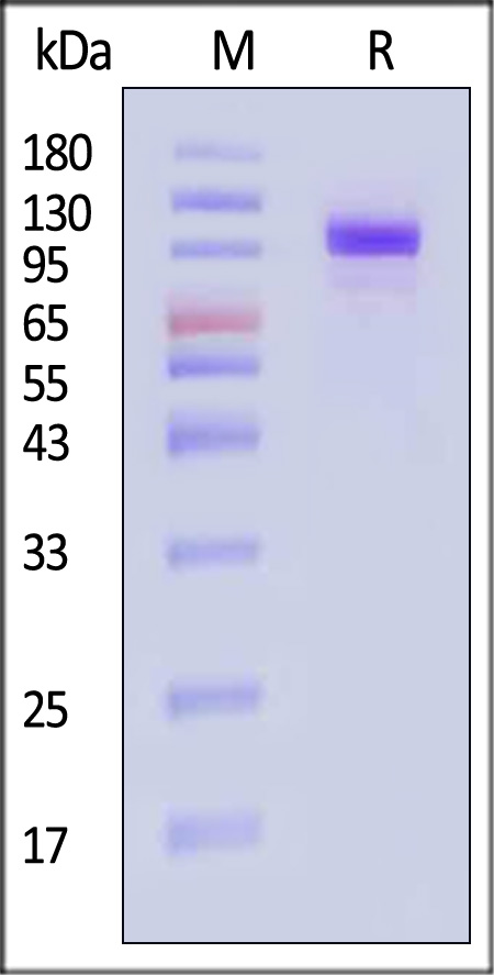 Hemagglutinin (HA) SDS-PAGE