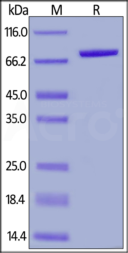 Human Serum Albumin, His Tag (Cat. No. HSA-H522a) SDS-PAGE gel