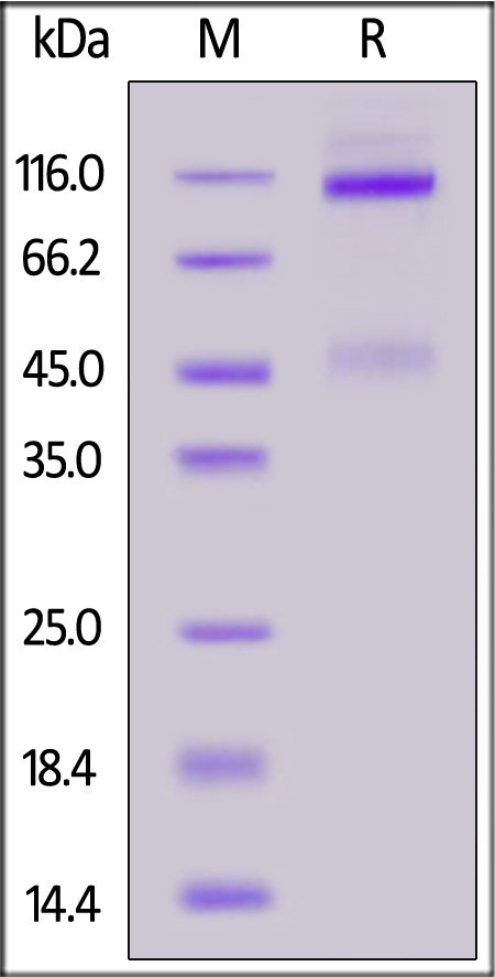 IGF-I R SDS-PAGE