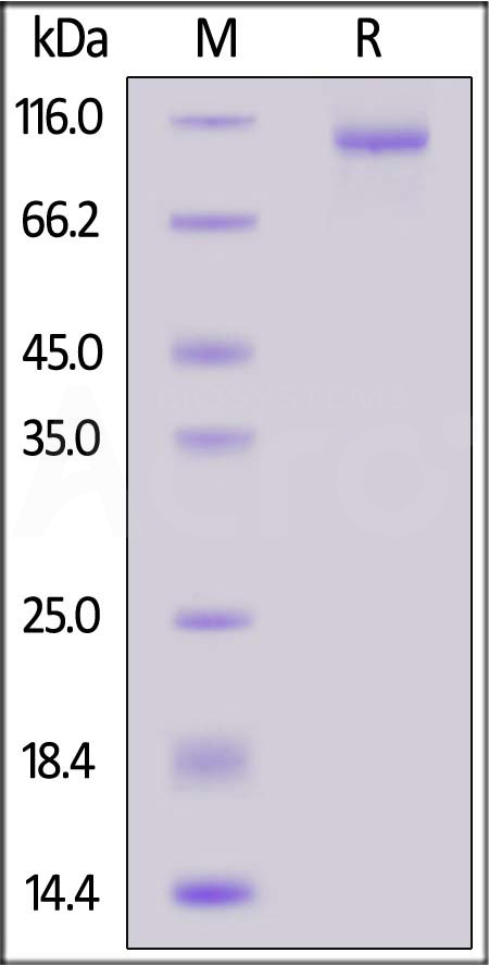 IL-12 R beta 1 SDS-PAGE