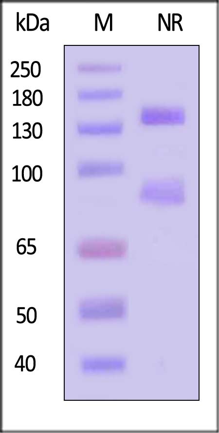 Integrin alpha V beta 5 SDS-PAGE