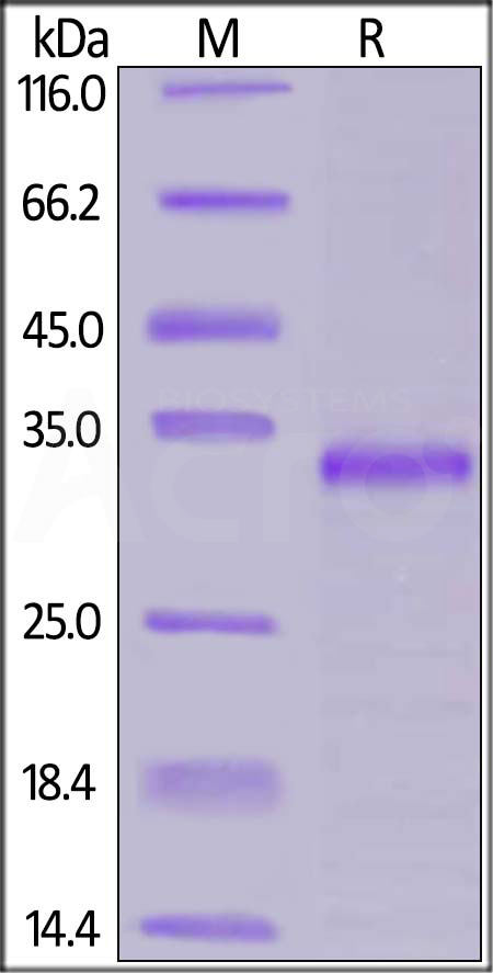 JAK1 SDS-PAGE