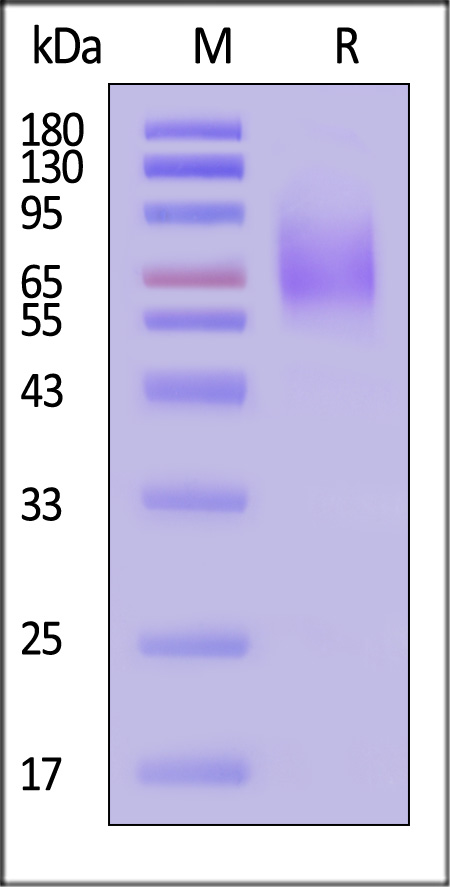 TIM-1 SDS-PAGE